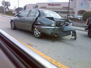 5 Reasons to Hire a Personal Injury Lawyer